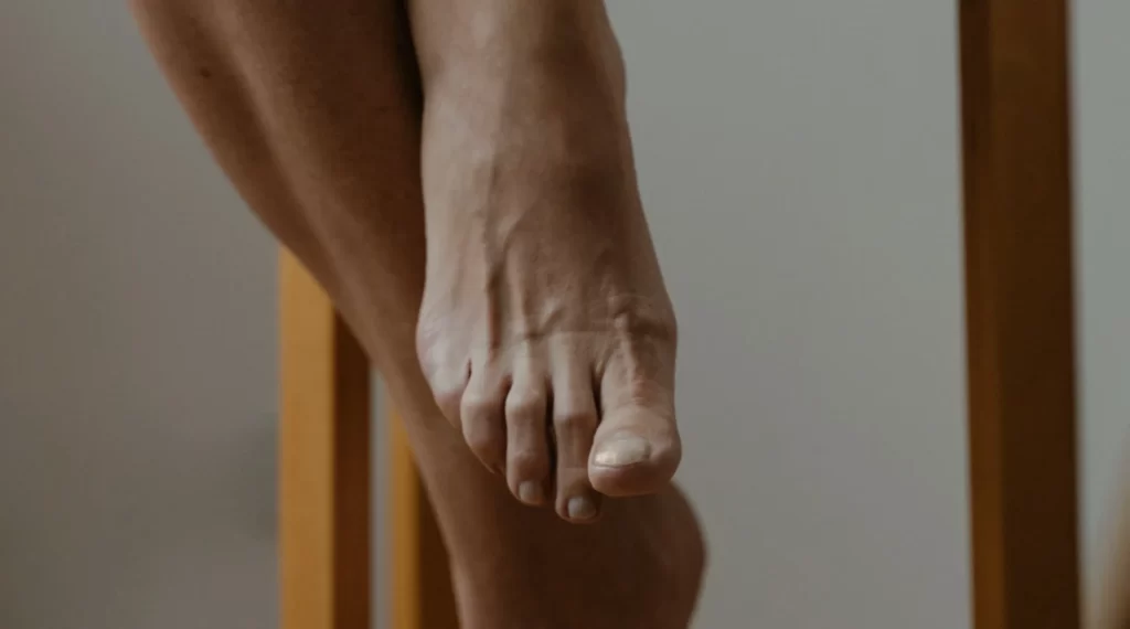 Best Insoles for Bunion Relief Top Picks to Soothe Your Feet Best