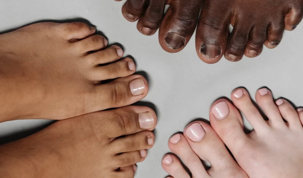 Best Insoles for Bunion Relief Top Picks to Soothe Your Feet Best Insoles Shose Insert