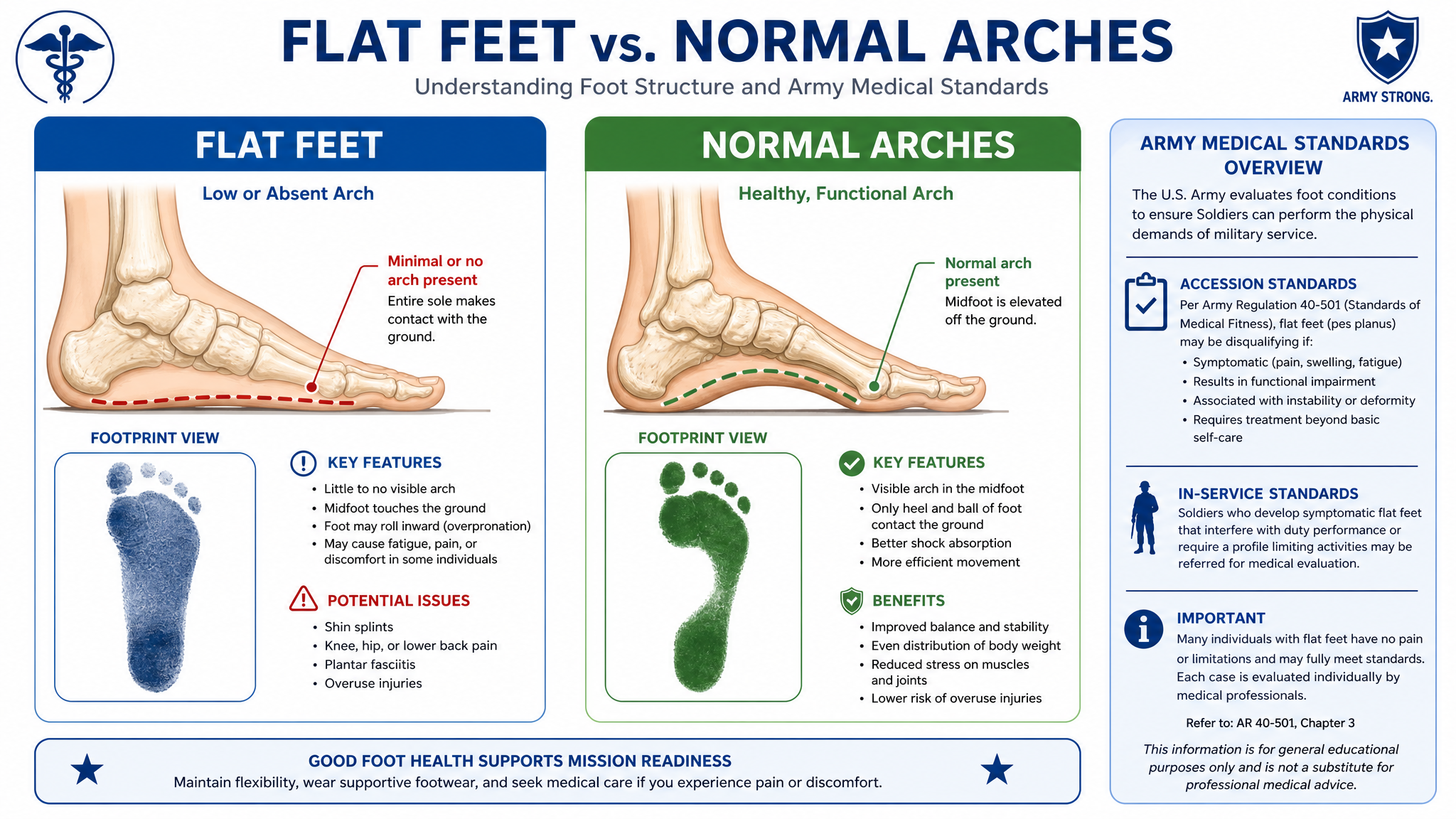 Army Medical Standards for Flat Feet