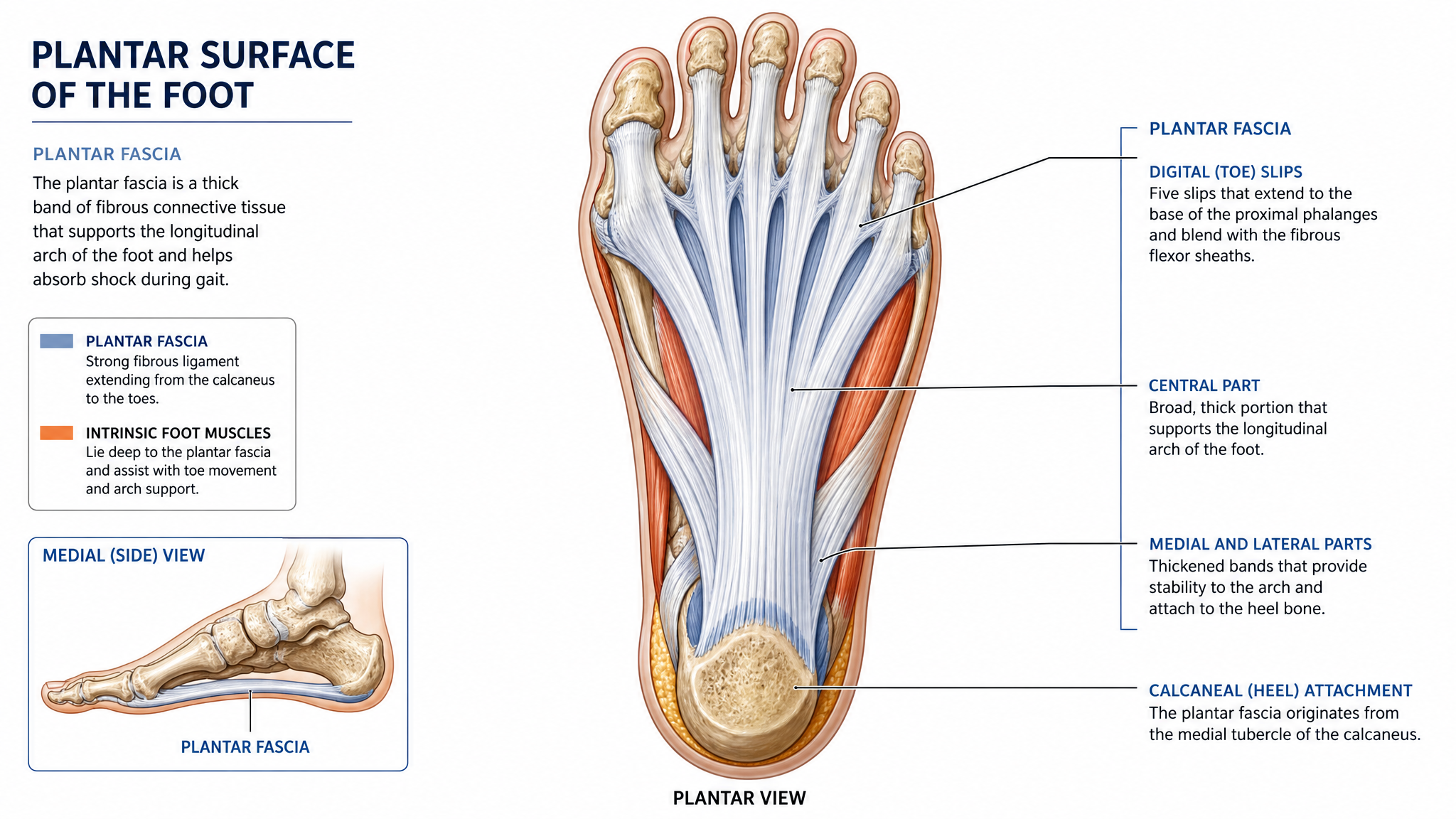 3. Plantar Fasciitis