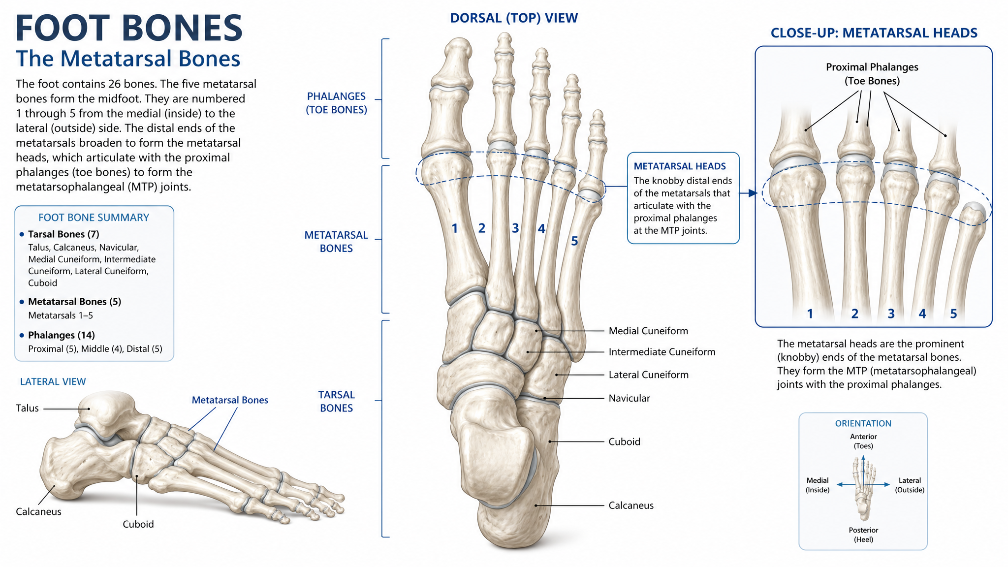 Foot anatomy showing metatarsal bones and metatarsal heads